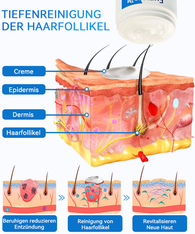 Furzero™ Hautaufhellende und erfrischende Creme