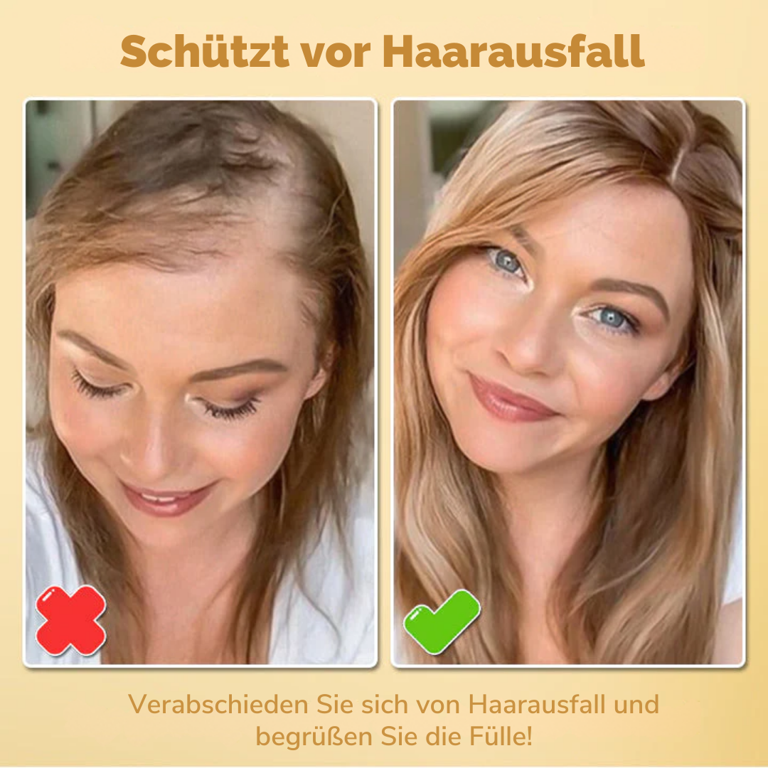 VitalHaar™ - Biotin Haarwuchsmittel Spray