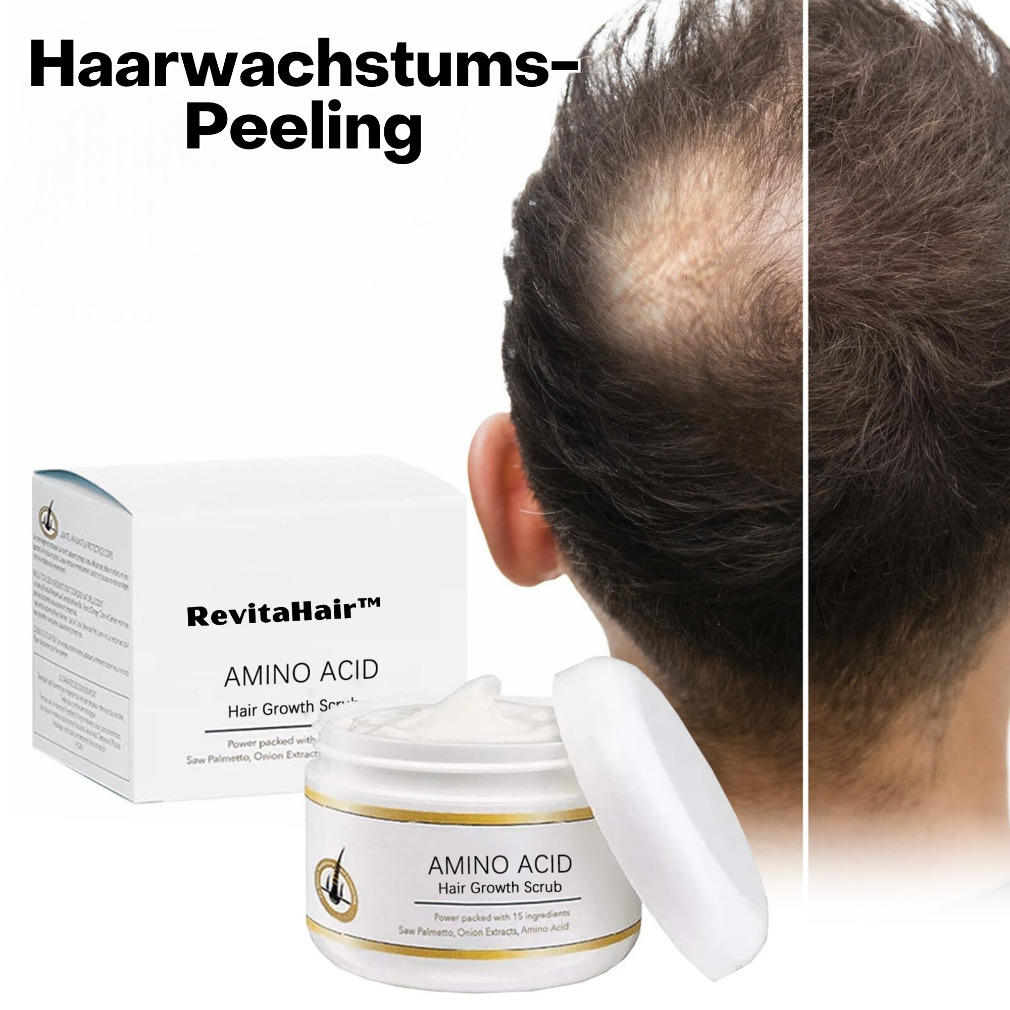 RevitaHair™️ I Haarwachstums-Peeling (1+1 GRATIS)