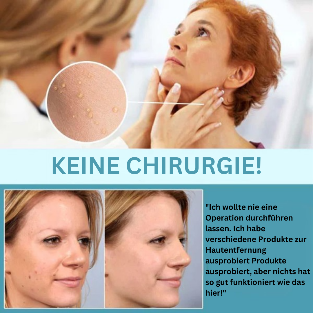 DermaFix™ Pflaster zur Entfernung von Hautmarkierungen