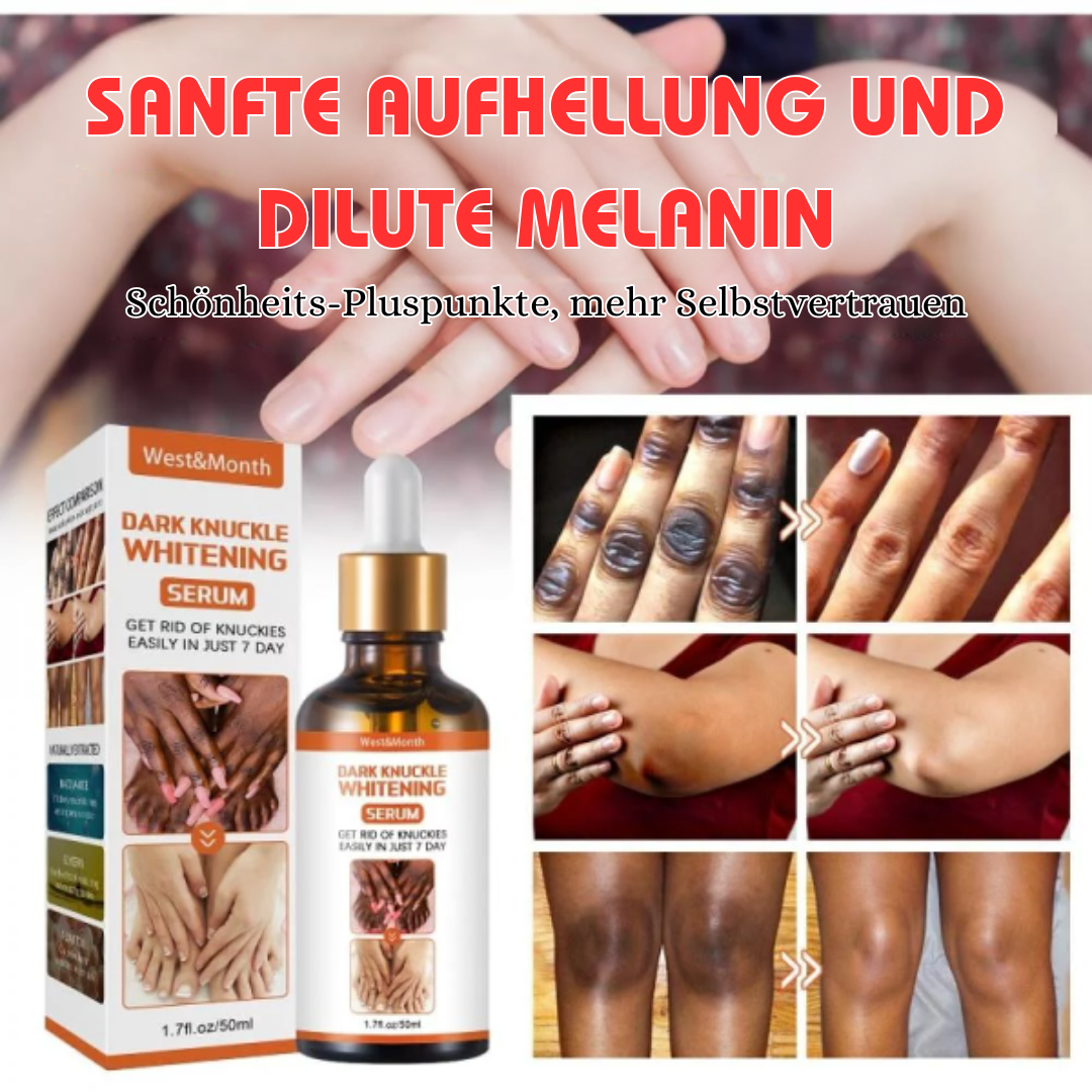 West&Month™ Serum zur Aufhellung dunkler Knöchel (1+1 GRATIS)