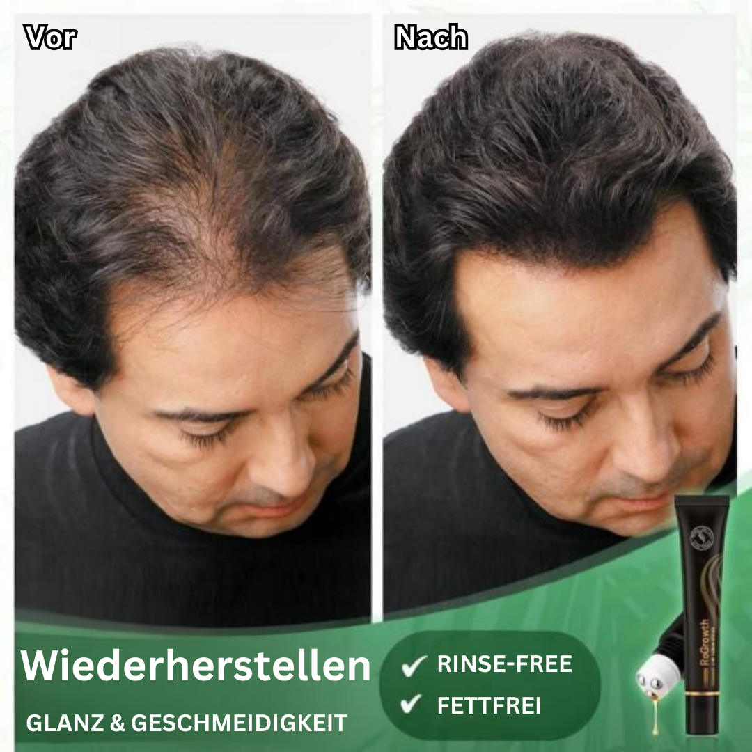 ReGrowth™ Bio-Haarwachstumsserum (1+1 GRATIS)