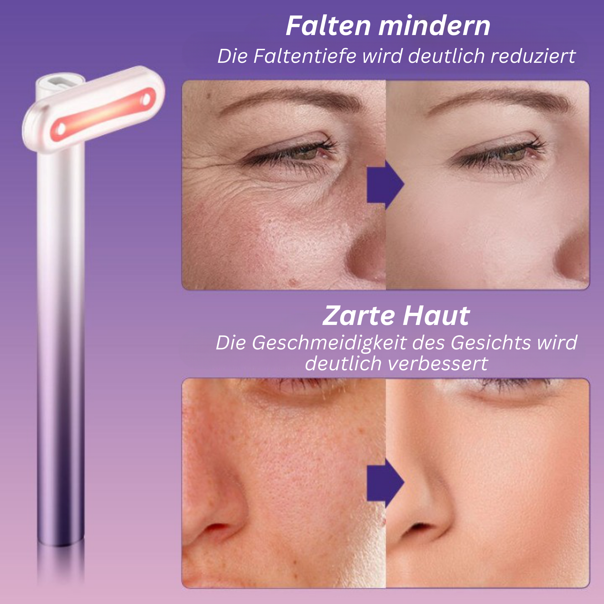 GlowWave™️ I Rotlichttherapie-Zauberstab