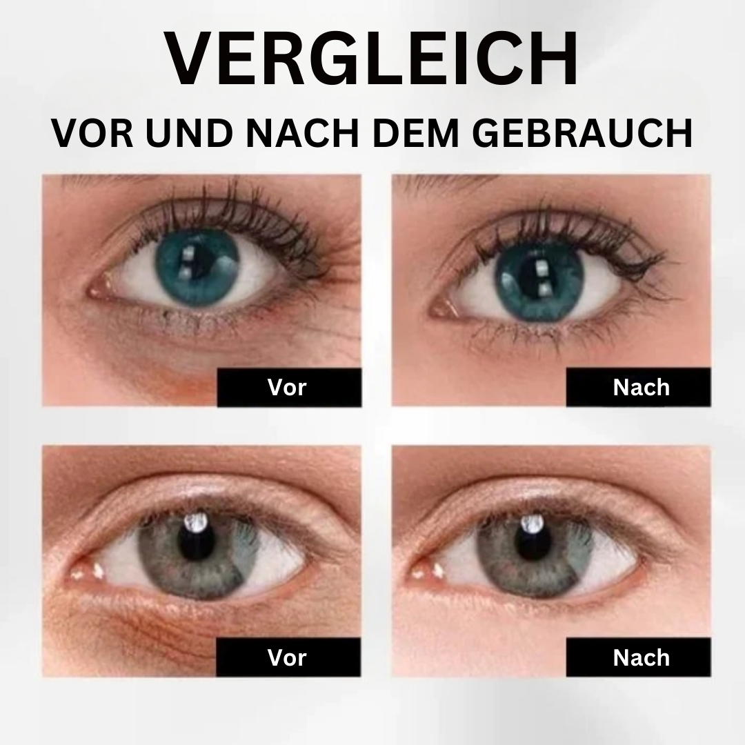 EELHOE™ Straffende Augencreme (1+1 GRATIS)