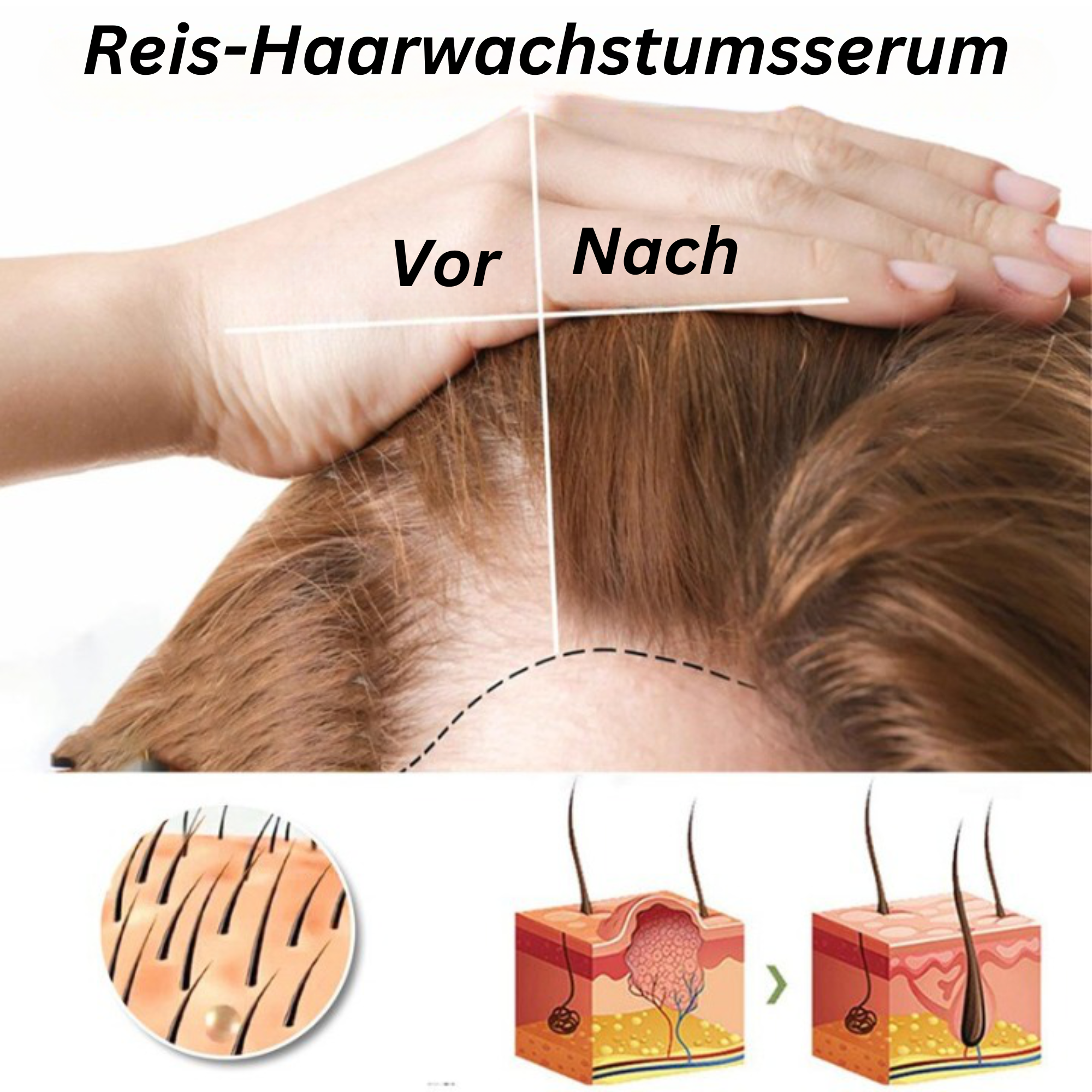 EELHOE™️ I Reis-Haarwachstumsserum (1+1 GRATIS)