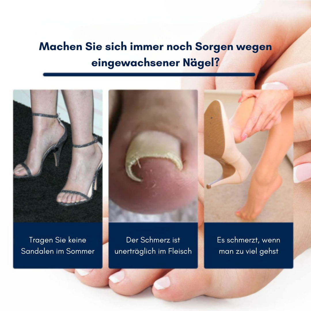 PediPatch™ Zehennagel-Korrekturpflaster (50+50 GRATIS)