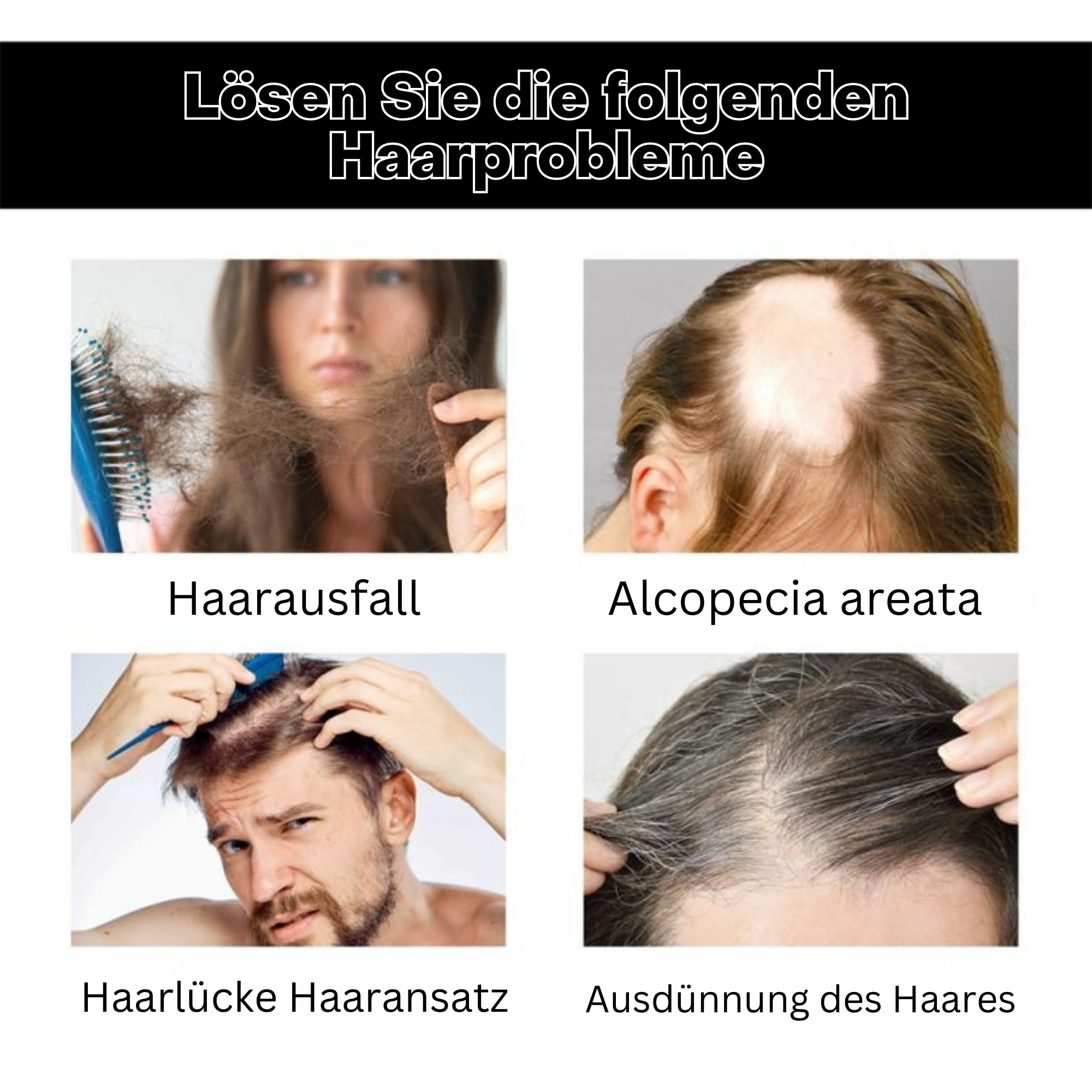 RevitaHair™️ I Haarwachstums-Peeling (1+1 GRATIS)