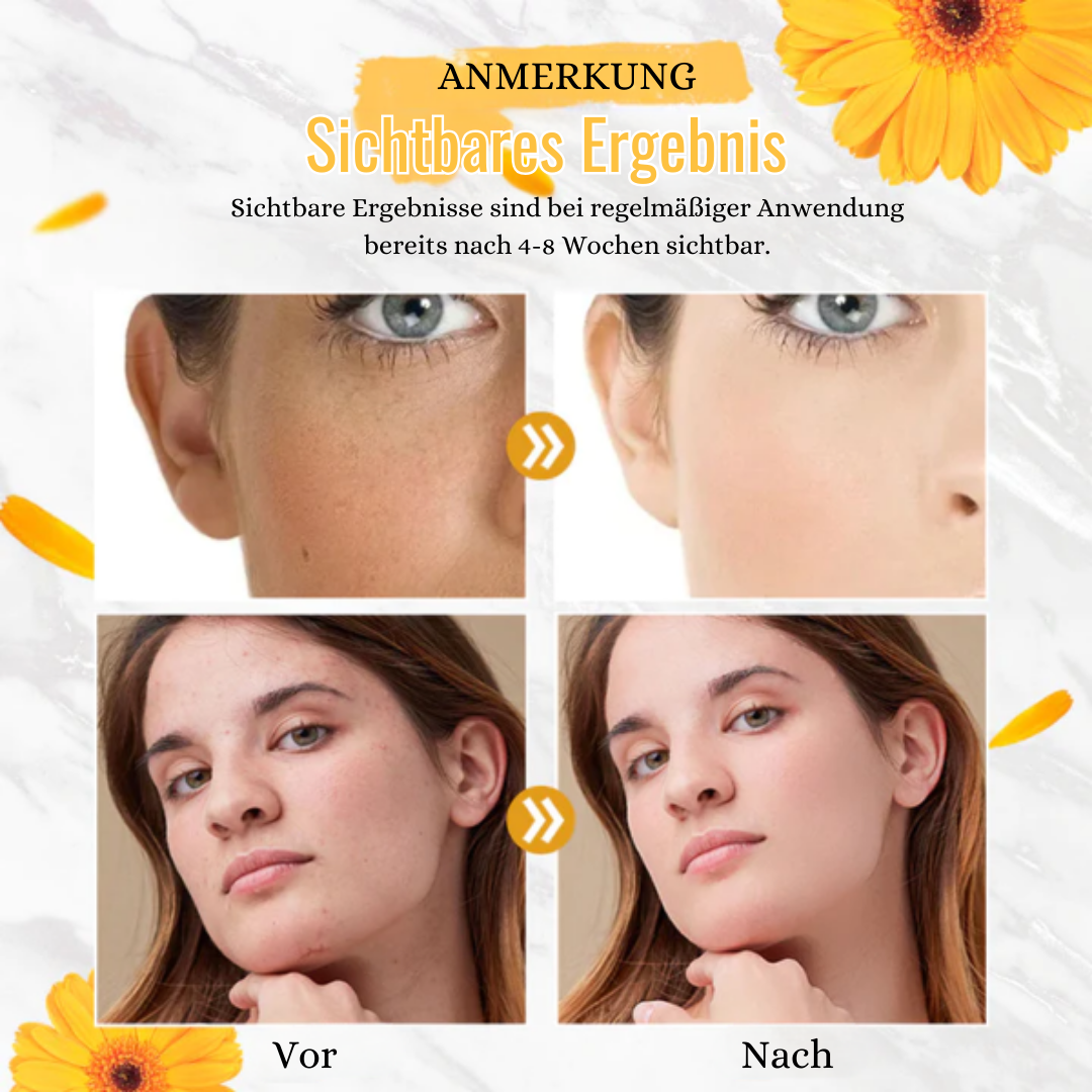 Glow Mask™ Calendula Essenzmaske