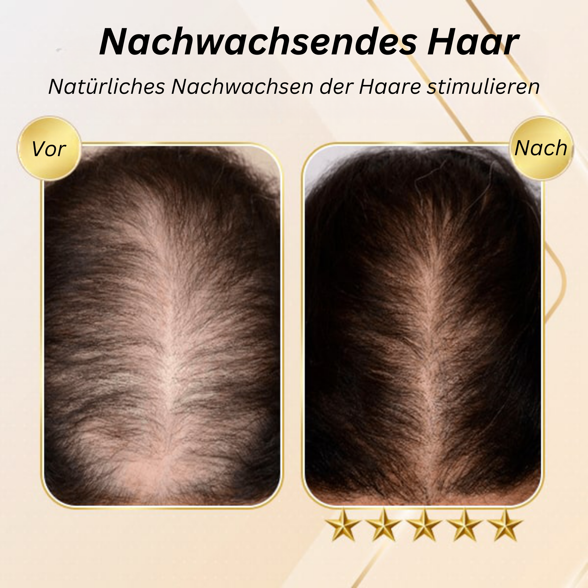 HerbHaven™️ I Ingwer Haarwuchs Shampoo Bar (2+2 GRATIS)