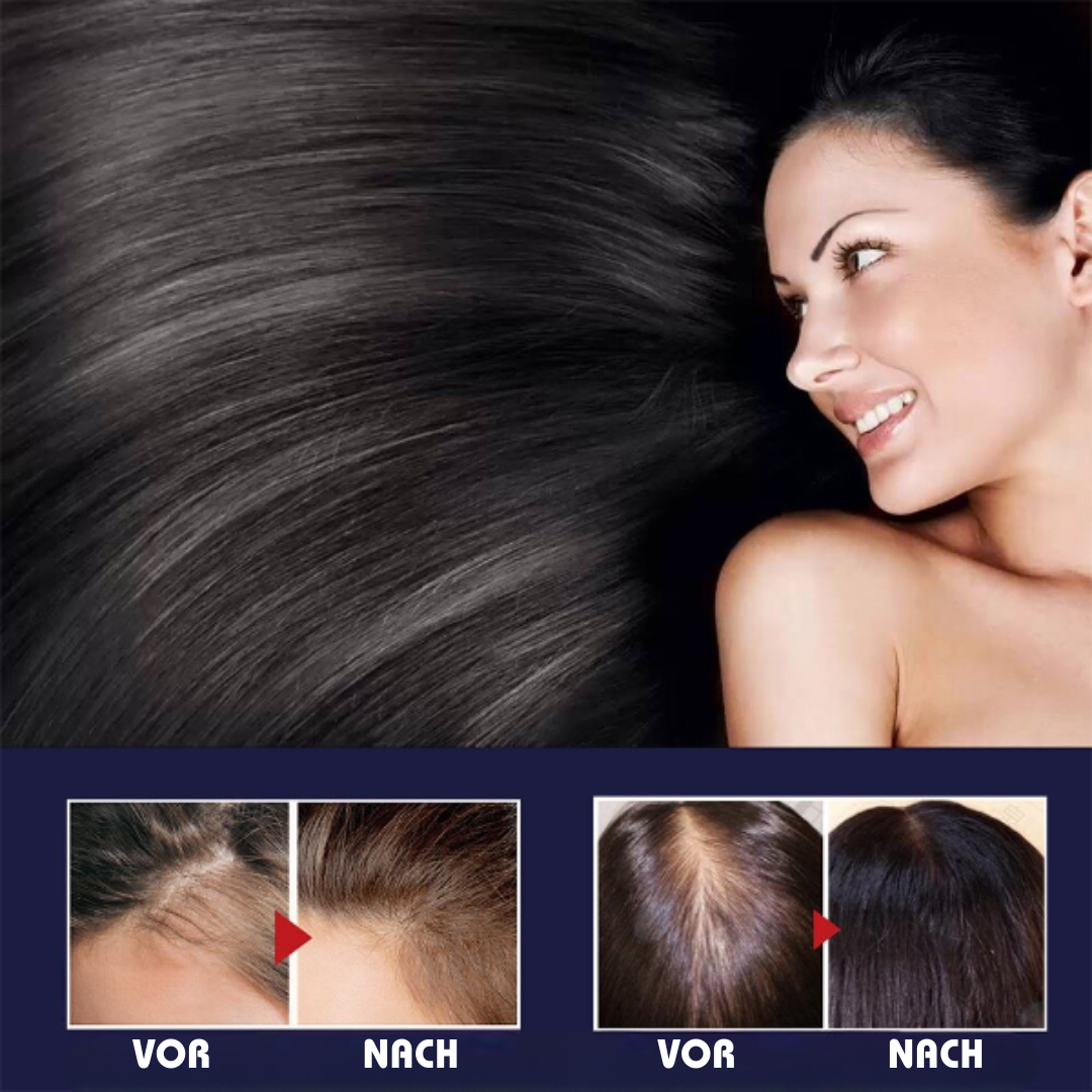 HairRevive™ Anti-Haarausfall-Wachstumsspray (1+1 GRATIS)