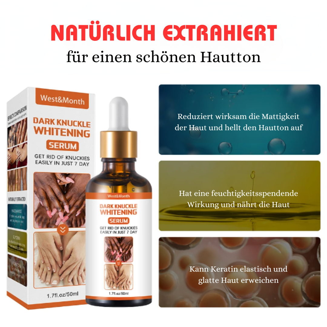 West&Month™ Serum zur Aufhellung dunkler Knöchel (1+1 GRATIS)