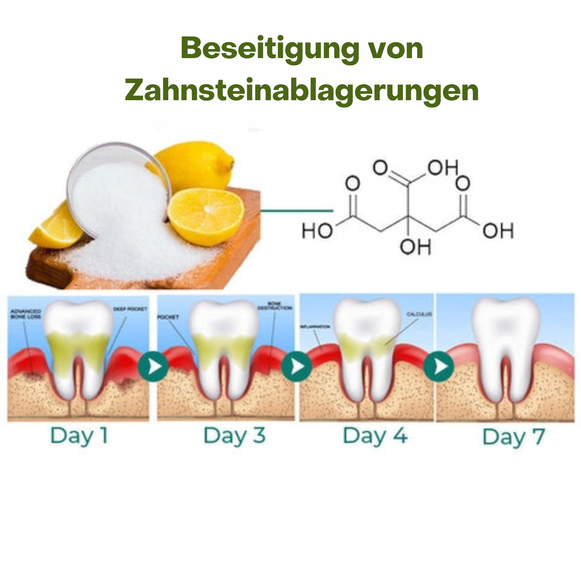 PureSmile™️ I Ampulle Zahnserum