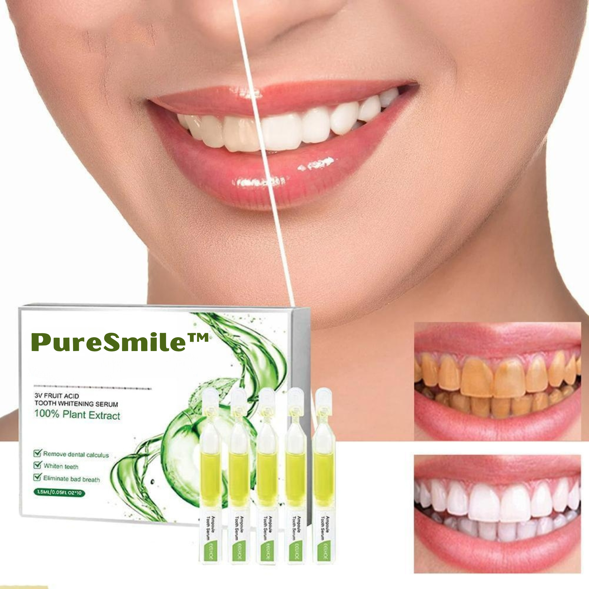 PureSmile™️ I Ampulle Zahnserum