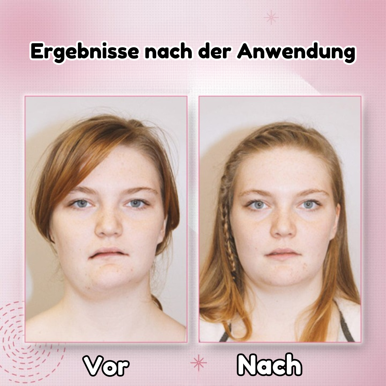 DreamCurve™ - EMS V-Gesicht Schönheit Gerät