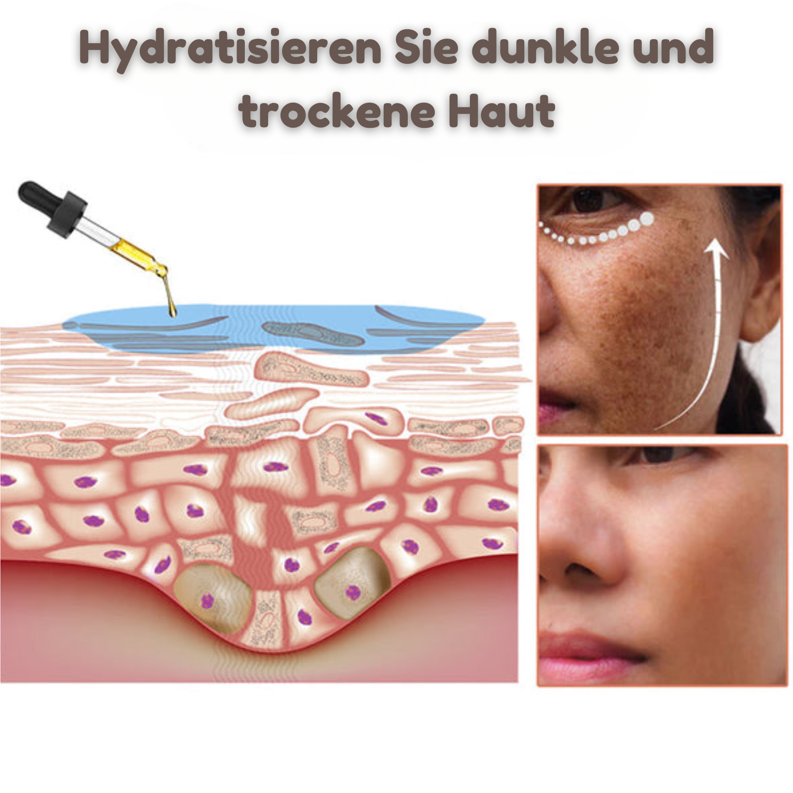 SkinQuench™ - Melanin korrigierendes Gesichtsserum (1+1 GRATIS)