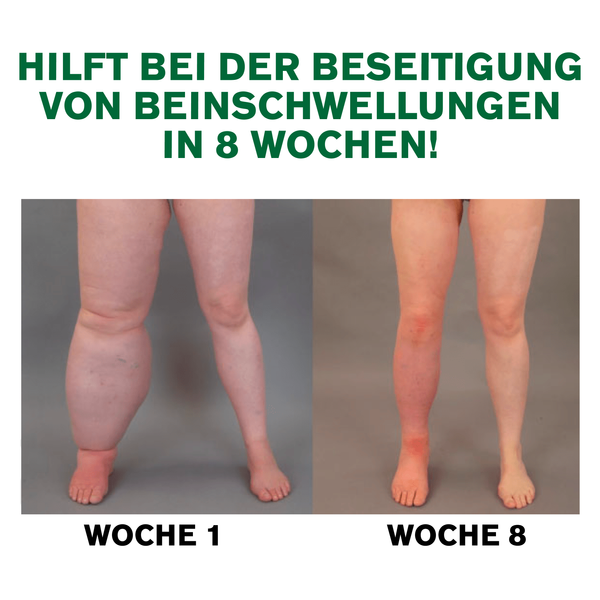 DeSwel™ Magnetische Therapie Ingwerpflaster (1+1 GRATIS)