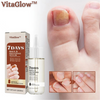 VitaGlow™ Nagelreparatur-Serum (1+1 GRATIS)