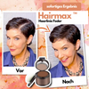 Hairmax™ Haarlinie Feder