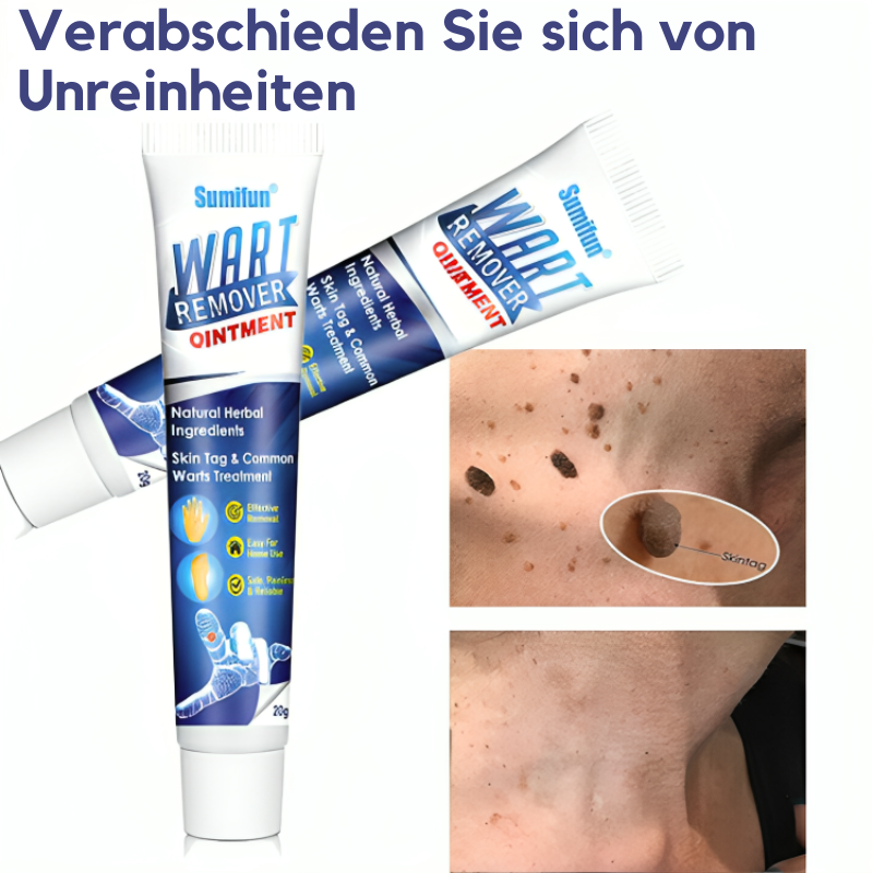 Sumifun® - Warzenentferner-Salbe (1+1 GRATIS)