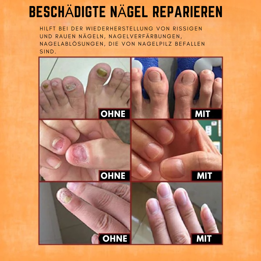 NailFix™ Reparaturserum für Nägel