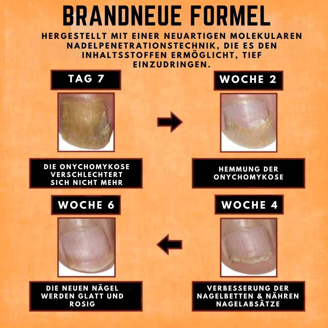 NailFix™ Reparaturserum für Nägel