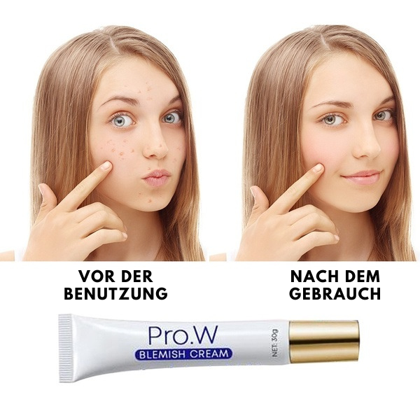 Pro.W™ - Hautunreinheiten-Creme (1+1 GRATIS)